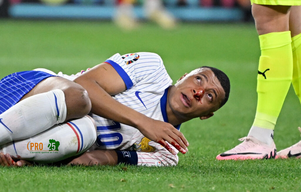 Kylian Mbappé fracture du nez Euro 2024